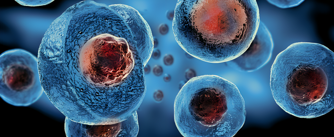 Strategies for Cure: Stem Cell Lymphocytic Leukemia Treatment and Procedures